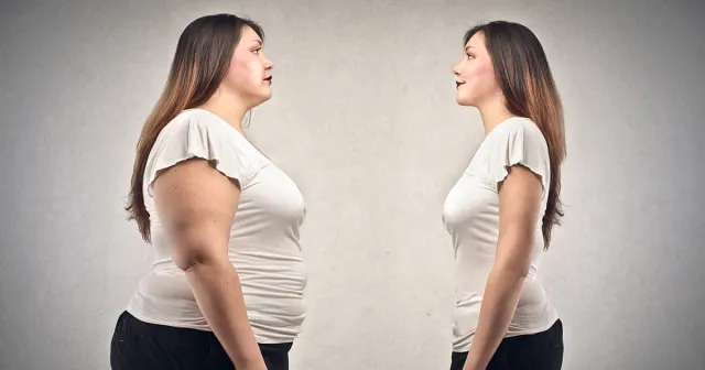 Bariatric Surgery Center
