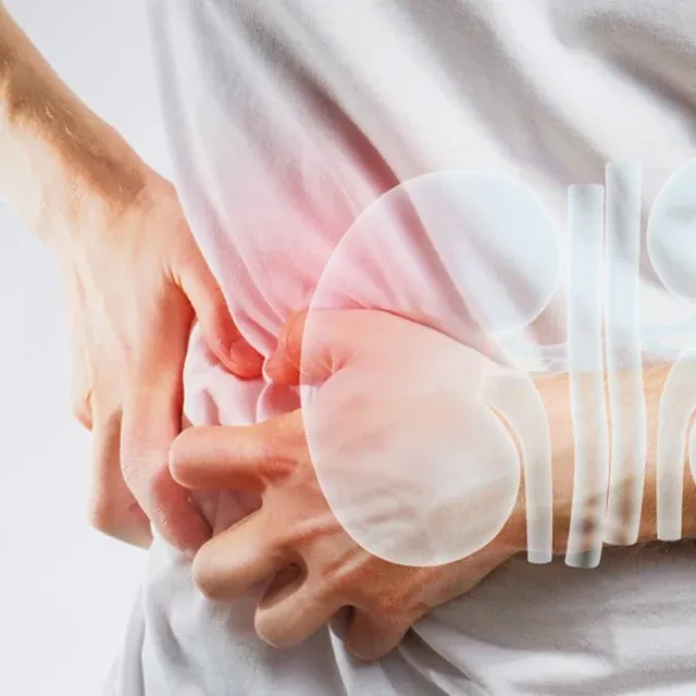 Kidney Health Screening
