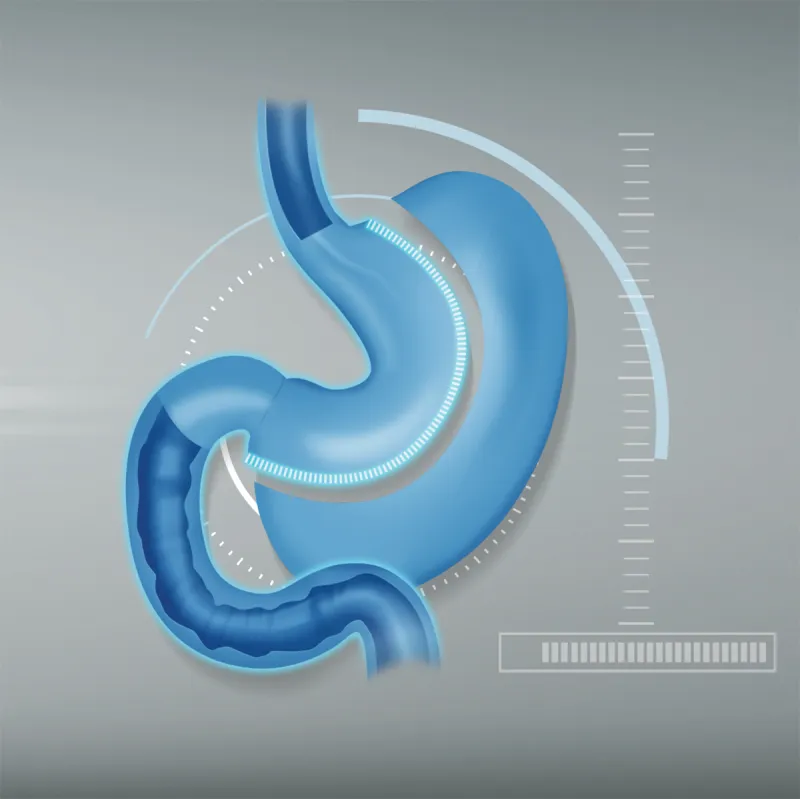 Bariatric Surgery Center Package